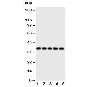 Western blot testing of FosB antibody and Lane 1: HT1080; 2: SW620; 3: HeLa; 4: SMMC-7721; 5: MM453 cell lysate