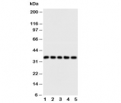 Western blot testing of FosB antibody and Lane 1:  HT1080;  2: SW620;  3: HeLa;  4: SMMC-7721;  5: MM453 cell lysate. Expected/observed molecular weight ~36 kDa.
