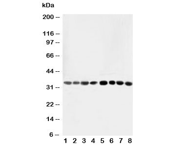 Western blot testing of AIMP2 antibody and Lane 1: rat liver; 2: rat lung; 3: rat kidney; 4: rat brain; 5: Jurkat; 6: CEM; 7: HUT; 8: U93T; 10: U93T cell lysate~