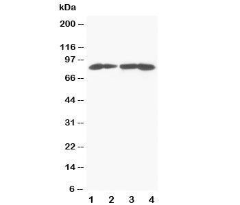 Western blot testing of MTA1 antibody and Lane 1: MCF-7; 2: HeLa; 3: Jurkat; 4: CEM cell lysate