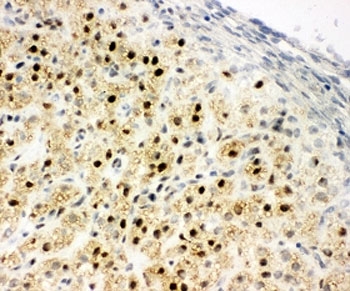 IHC-F: MTA1 antibody testing of rat ovary tissue