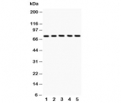 Western blot testing of 12 Lipoxygenase antibody and Lane 1:  A549;  2: MCF-7;  3: COLO320;  4: Jurkat;  5: HeLa;  Predicted size: 75KD;  Observed size: 75KD