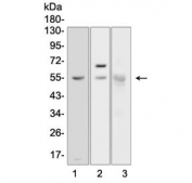 Western blot testing of 1) human PANC-1, 2) rat pancreas and 3) mouse pancreas lysate with Alpha Amylase 1 antibody. Expected molecular weight ~58 kDa.
