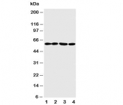 Western blot testing of ANGPTL1 antibody and Lane 1:  A549;  2: SW620;  3: MCF-7;  4: MM231 cell lysate