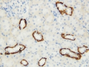 IHC-P: AQP3 antibody testing of rat kidney tissue. HIER: Boil the paraffin sections in 10mM citrate buffer, pH6, for 20 mins.