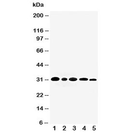 Western blot testing of AQP3 antibody and Lane 1: rat kidney; 2: (r) lung; 3: mouse kidney; 4: human MDA-MB-453; 5: (h) SMMC-7221 cell lysate