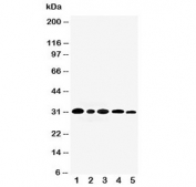 Western blot testing of AQP3 antibody and Lane 1:  rat kidney;  2: (r) lung;  3: mouse kidney;  4: human MDA-MB-453 (breast carcinoma);  5: (h) SMMC-7221 (hepatocarcinoma) cell lysate. Predicted molecular weight ~32 kDa.