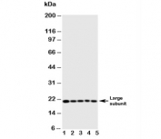 Western blot testing of human 1) MCF-7, 2) HeLa, 3) Jurkat, 4) CCRF-CEM, 5) SW620 cell lysate with Caspase-4 antibody. Expected molecular weight ~43 kDa (precursor), ~30 kDa (pro domain + large subunit), ~20 kDa (large subunit).