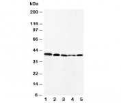 Western blot testing of CCR10 antibody and Lane 1:  HeLa;  2: SW620;  3: A549;  4: MM231;  5: SMMC-7721 cell lysate. Predicted molecular weight ~38 kDa.