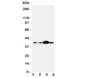 Western blot testing of APEX1 antibody and human samples 1: U87; 2: A549; 3: SMMC-7721; 4: HeLa cell lysate. Expected/observed size ~38KD