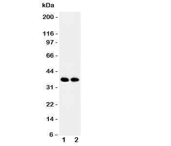 Western blot testing of APEX1 antibody and Lane 1: rat brain; 2: mouse brain tissue lysate. Expected/observed size ~38KD