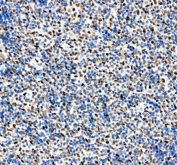 IHC staining of FFPE human spleen tissue with APEX1 antibody. HIER: boil tissue sections in pH8 EDTA for 20 min and allow to cool before testing.