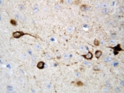 IHC-P: CaMKK2 antibody testing of rat brain tissue.