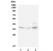Western blot testing of rat 1) liver, 2) kidney and 3) heart lysate with IGFBP3 antibody. Expected molecular weight: ~31/40-44 kDa (unmodified/glycosylated).