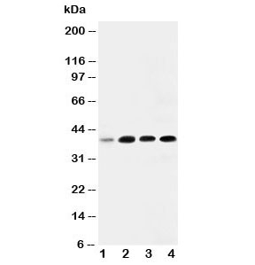 Western blot testing of IGFBP3 antibody and Lane 1: 293T; 2: MCF- 7; 3: A549; 4: SW620. Expected molecular weight: ~31/40-44 kDa (unmodified/glycosylated).~