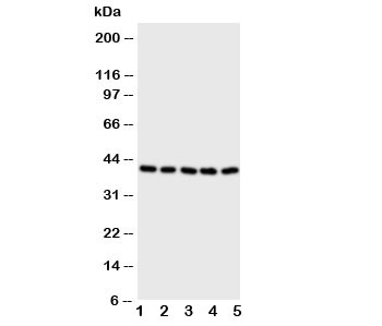 Western blot testing of BCAT2 antibody and Lane 1: A431; 2: SW620; 3: SMMC-7721; 4: Jurkat; 5: CEM cell lysate~