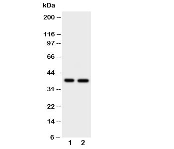 Western blot testing of MCL-1 antibody and Lane 1: HeLa; 2: MCF-7 cell lysate