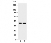 Western blot testing of MCL-1 antibody and Lane 1:  HeLa;  2: MCF-7 cell lysate. Predicted molecular weight ~37kDa.