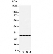 Western blot testing of Bcl10 antibody and Lane 1:  U87;  2: MCF-7;  3: HeLa;  4: COLO320 cell lysate. Observed molecular weight: 26~33 kDa.
