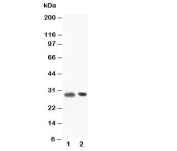 Western blot testing of BOB-1 antibody and Lane 1:  rat spleen tissue lysate. Predicted molecular weight: ~28/35-40kDa (unmodified/ubiquitinated).