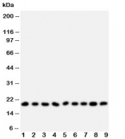 Western blot testing of Ribonuclease A antibody and Lane 1:  MCF-7;  2: U87;  3: HeLa;  4: MM231;  5: Jurkat;  6: SMMC-7721;  7: COLO320;  8: SW620;  9: CEM;  Predicted size: 18KD;  Observed size: 18KD