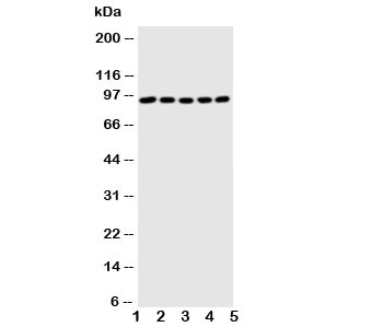 Western blot testing of STAT1 antibody and Lane 1: MM451; 2: HeLa; 3: HT1080; 4: SW620; 5: Jurkat cell lysate. Predicted molecular weight: 84 and 91 kDa.