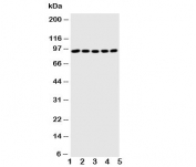 Western blot testing of STAT1 antibody and Lane 1:  MM451;  2: HeLa;  3: HT1080;  4: SW620;  5: Jurkat cell lysate. Predicted molecular weight: ~91/84 kDa (alpha/beta).