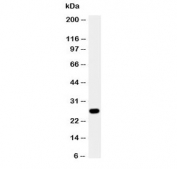 Western blot testing of Aquaporin 8 antibody and A431 cell lysate.  The ~27 kDa protein may be visualized at higher molecular weights due to glycosylation.