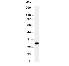Western blot testing of Aquaporin 8 antibody and A431 cell lysate. The ~27KD protein may be visualized at higher molecular weights due to glycosylation.