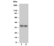 Western blot testing of Aquaporin 8 antibody and Lane 1:  SW620;  2: COLO320 cell lysate.  The ~27 kDa protein may be visualized at higher molecular weights due to glycosylation.