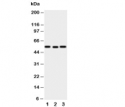 Western blot testing of XIAP antibody and Lane 1:  SMMC-7721;  2: HeLa;  3: A431 cell lysate. Expected/observed molecular weight ~57 kDa.