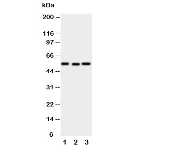 Western blot testing of XIAP antibody and Lane 1: SMMC-7721; 2: HeLa; 3: A431 cell lysate