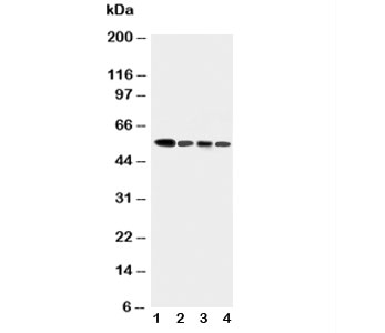 Western blot testing of Caspase-10 antibody and human tumor cell lysates 1:  COLO320;  2: HeLa;  3: SW620;  4: Raji.