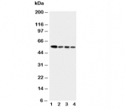 Western blot testing of Caspase-10 antibody and human tumor cell lysates 1:  COLO320;  2: HeLa;  3: SW620;  4: Raji. 