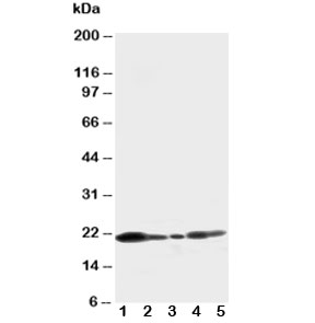Western blot testing of Caveolin-1 antibody and Lane 1: U87; 2: HeLa; 3: MCF-7; 4: A549; 5: HT1080 cell lysate~