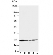 Western blot testing of Caveolin-1 antibody and Lane 1:  U87;  2: HeLa;  3: MCF-7;  4: A549;  5: HT1080 cell lysate. Predicted molecular weight ~21/17kDa (alpha/beta isoforms)