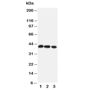 Western blot testing of CCR4 antibody and Lane 1: rat thymus; 2: rat spleen; 3: mouse HEPA cell lysate. Predicted/observed molecular weight: ~41kDa.