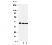 Western blot testing of CCR4 antibody and Lane 1:  rat thymus;  2: rat spleen;  3: mouse HEPA cell lysate. Predicted/observed molecular weight: ~41 kDa.