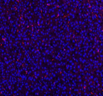 IHC testing of FFPE rat liver tissue with CD68 antibody at 1ug/ml. Required HIER: steam section in pH6 citrate buffer for 20 min and allow to cool prior to staining.
