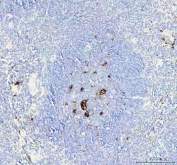 IHC testing of FFPE mouse liver tissue with CD68 antibody at 1ug/ml. Required HIER: steam section in pH6 citrate buffer for 20 min and allow to cool prior to staining.