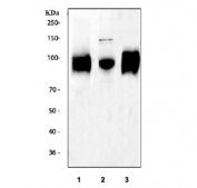 Western blot testing of 1) rat spleen, 2) mouse spleen and 3) mouse RAW lysate with CD68 antibody.  This protein can be highly glycosylated and is routinely visualized from 37~110 kDa.