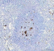 IHC staining of FFPE mouse spleen tissue with Cd68 antibody. HIER: boil tissue sections in pH8 EDTA for 20 min and allow to cool before testing.