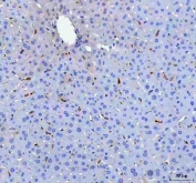 IHC staining of FFPE mouse liver tissue with Cd68 antibody. HIER: boil tissue sections in pH8 EDTA for 20 min and allow to cool before testing.