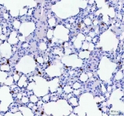 IHC staining of FFPE mouse lung tissue with Cd68 antibody. HIER: boil tissue sections in pH8 EDTA for 20 min and allow to cool before testing.