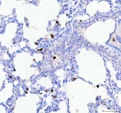 IHC staining of FFPE rat lung tissue with Cd68 antibody. HIER: boil tissue sections in pH8 EDTA for 20 min and allow to cool before testing.