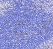 IHC staining of FFPE mouse spleen tissue with Cd68 antibody. HIER: boil tissue sections in pH8 EDTA for 20 min and allow to cool before testing.