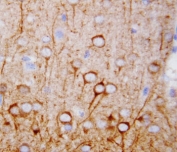IHC-P: CaMKK antibody testing of rat brain tissue