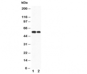 Western blot testing of CaMKK antibody and Lane 1:  rat brain;  2: mouse brain