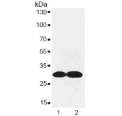 Western blot testing of rat 1) kidney and 2) lung lysate with Canstatin / Collagen IV antibody at 0.5ug/ml. Expected molecular weight of Canstatin: ~24 kDa.