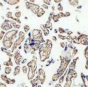 Western blot testing of rat 1) kidney and 2) lung lysate with Canstatin / Collagen IV antibody at 0.5ug/ml. Expected molecular weight of Canstatin: ~24 kDa.